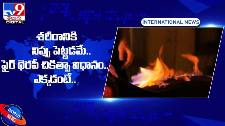 Fire Therapy: శరీరానికి నిప్పు పెట్టడమే !! ఫైర్ థెరపీ చికిత్సా విధానం.. ఎక్కడంటే ?? Fire Therapy: శరీరానికి నిప్పు పెట్టడమే !! ఫైర్ థెరపీ చికిత్సా విధానం.. ఎక్కడంటే ??