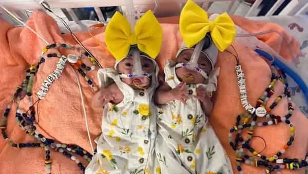 Identical Twins: అసాధారణ కవలలకు జన్మనిచ్చిన మహిళ.. మూడు రోజుల తేడాతో పుట్టిన చిన్నారులు