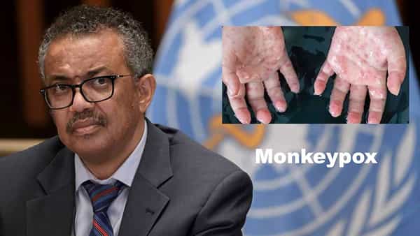 Monkeypox: డబ్ల్యూహెచ్ఎన్ హెచ్చరిక! మంకీపాక్స్ను మహమ్మారిగా ప్రకటన.. వ్యాప్తి అడ్డుకోకుంటే లక్షల్లో మరణాలు..