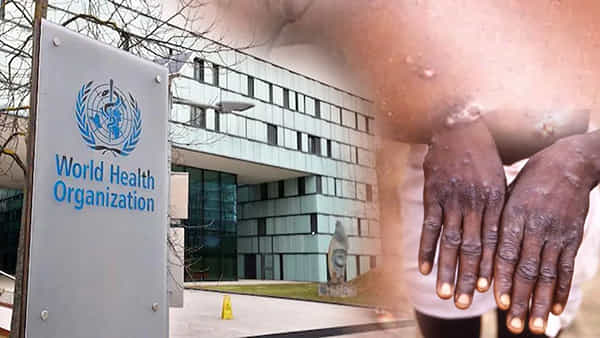 Monkeypox: మంకీపాక్స్ కేసుల పెరుగుదలపై ప్రపంచ ఆరోగ్య సంస్థ కీలక సూచనలు..!