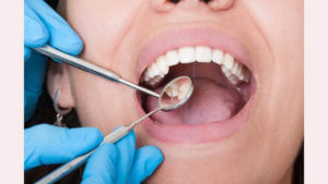 Oral Health: ఈ మూడు రకాల వ్యాధులు దంతాలలో సంభవిస్తాయి.. నిర్లక్ష్యం చేస్తే ఇబ్బందులే..
