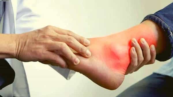 Reduce Uric Acid: ఈ కారణాల వల్ల యూరిక్ యాసిడ్ మళ్లీ మళ్లీ పెరుగుతుంది.. నొప్పి తగ్గాలంటే ఇలా చేయండి..