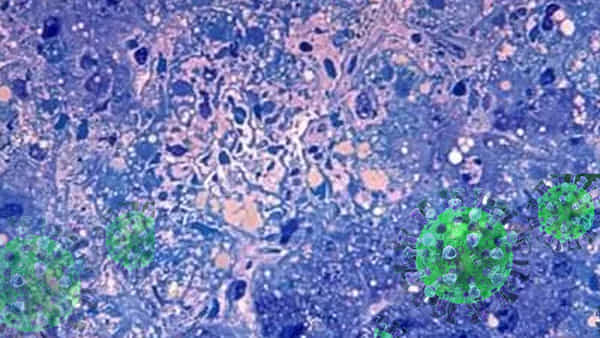 Zoonosis Diseases: ఆ వ్యాధులకు అదే కారణం.. అప్రమత్తం కాకపోతే మరణమే.! వివరాలు ఇవే!