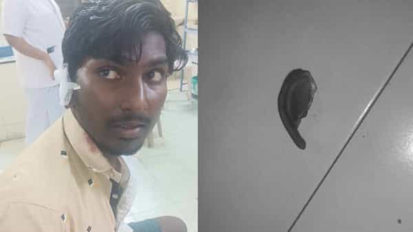 Andhra Pradesh: ఫ్యామిలీ మధ్య గొడవ.. బాబాయ్ చెవి ఊడేలా కొరికేసిన అబ్బాయ్.. చెవి పట్టుకుని ఆస్పత్రికి పరుగో పరుగు