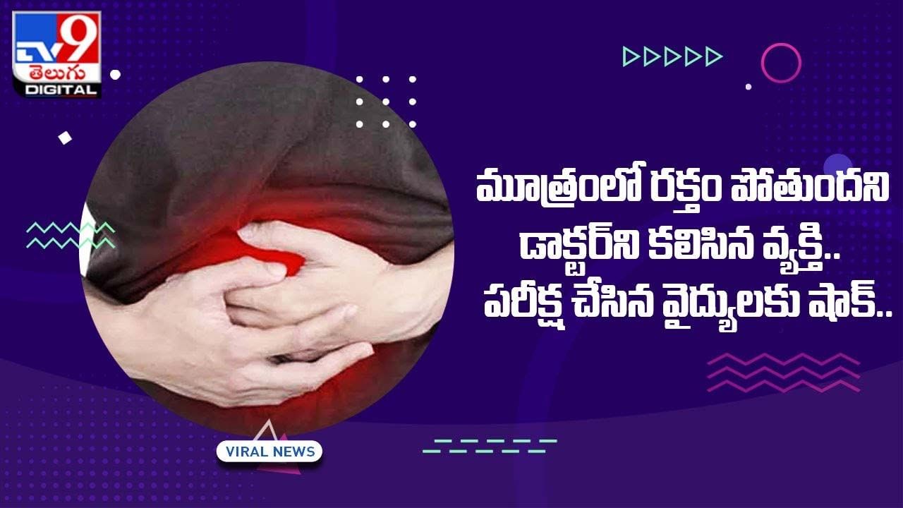 మూత్రంలో రక్తం పోతుందని డాక్టర్‌ని కలిసిన వ్యక్తి.. పరీక్ష చేసిన వైద్యులకు షాక్‌