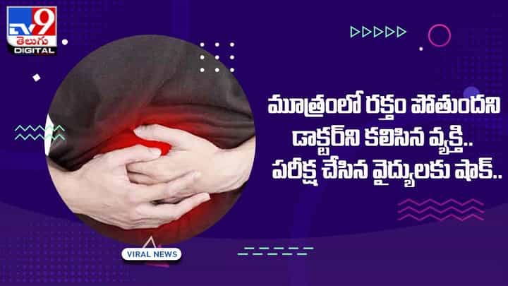 మూత్రంలో రక్తం పోతుందని డాక్టర్ని కలిసిన వ్యక్తి.. పరీక్ష చేసిన వైద్యులకు షాక్ మూత్రంలో రక్తం పోతుందని డాక్టర్ని కలిసిన వ్యక్తి.. పరీక్ష చేసిన వైద్యులకు షాక్