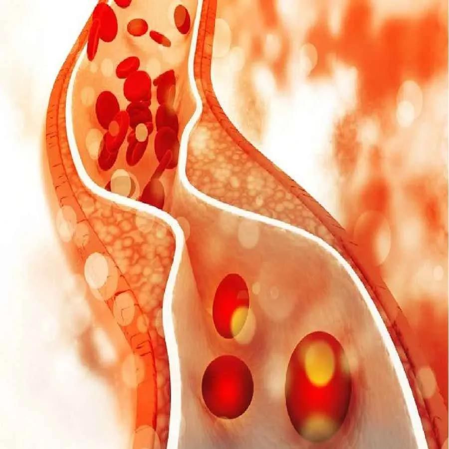 Cholesterol Control Tips