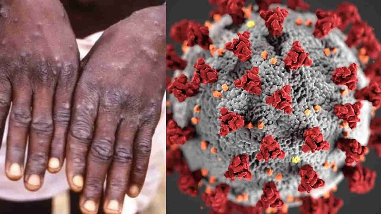 Monkeypox vs Covid 19: మంకీపాక్స్, కరోనా వైరస్ మధ్య సారూప్యతలు ఉన్నాయా?