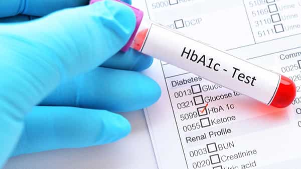 Diabetes Test: ప్రతి 3 నెలలకు చక్కెర స్థాయి ఎంత ఉండాలి? HbA1c పరీక్ష ఎందుకు ముఖ్యమో తెలుసుకోండి..