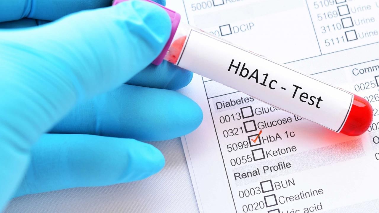 Diabetes Test:  ప్రతి 3 నెలలకు చక్కెర స్థాయి ఎంత ఉండాలి? HbA1c పరీక్ష ఎందుకు ముఖ్యమో తెలుసుకోండి..