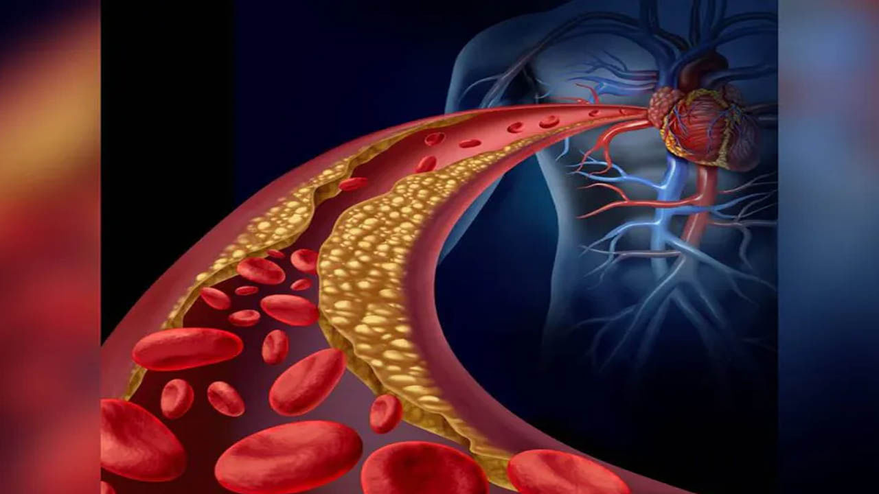 High Cholesterol: శరీరంలో కొలెస్ట్రాల్ స్థాయి పెరిగినప్పుడు ఈ సంకేతాలు వెలువడుతాయి..!