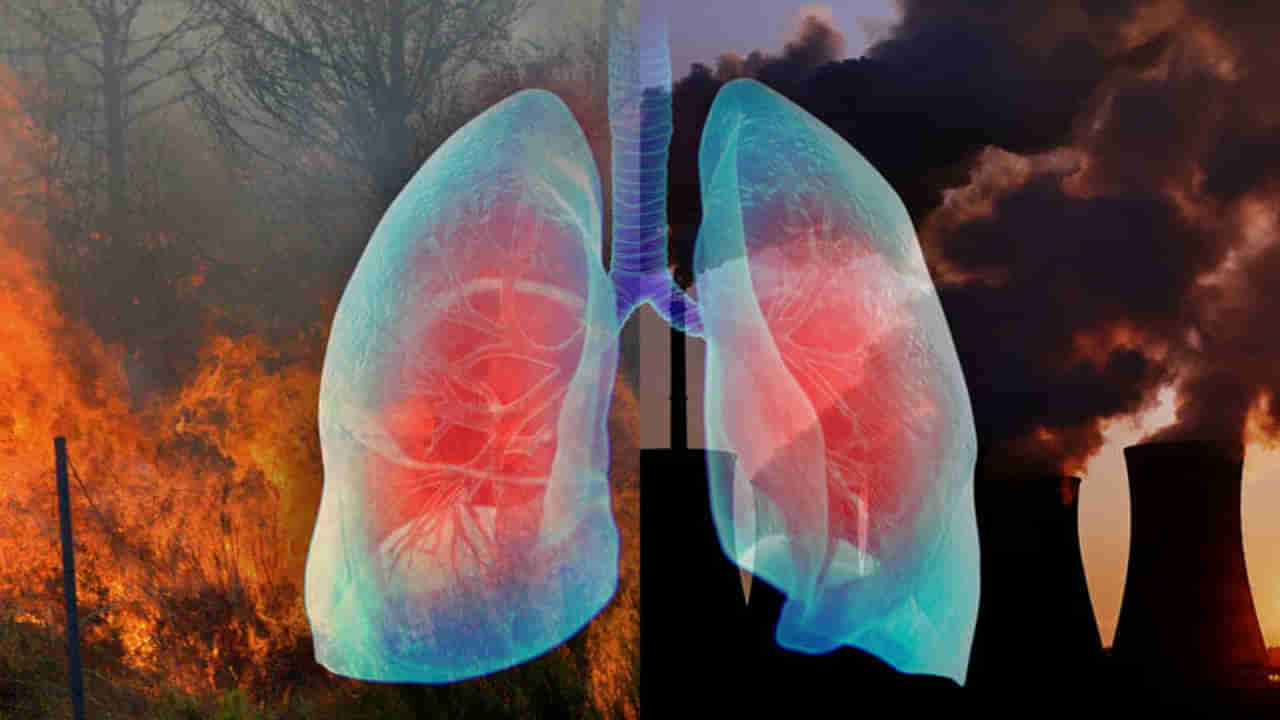 Pollution: వాయు కాలుష్యంతో ఆస్తమానే కాదు.. ఈ 5 వ్యాధులు కూడా వచ్చే ప్రమాదముంది..!