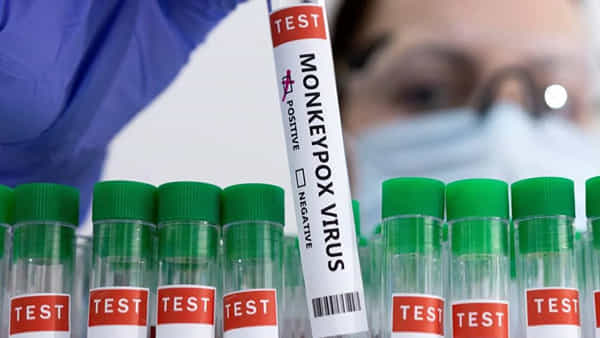 Monkeypox: తెలంగాణకు మంకీపాక్స్ ముప్పు తప్పేనా? కామారెడ్డి బాధితుడి సాంపిల్ రిజల్ట్ ఎప్పుడంటే?