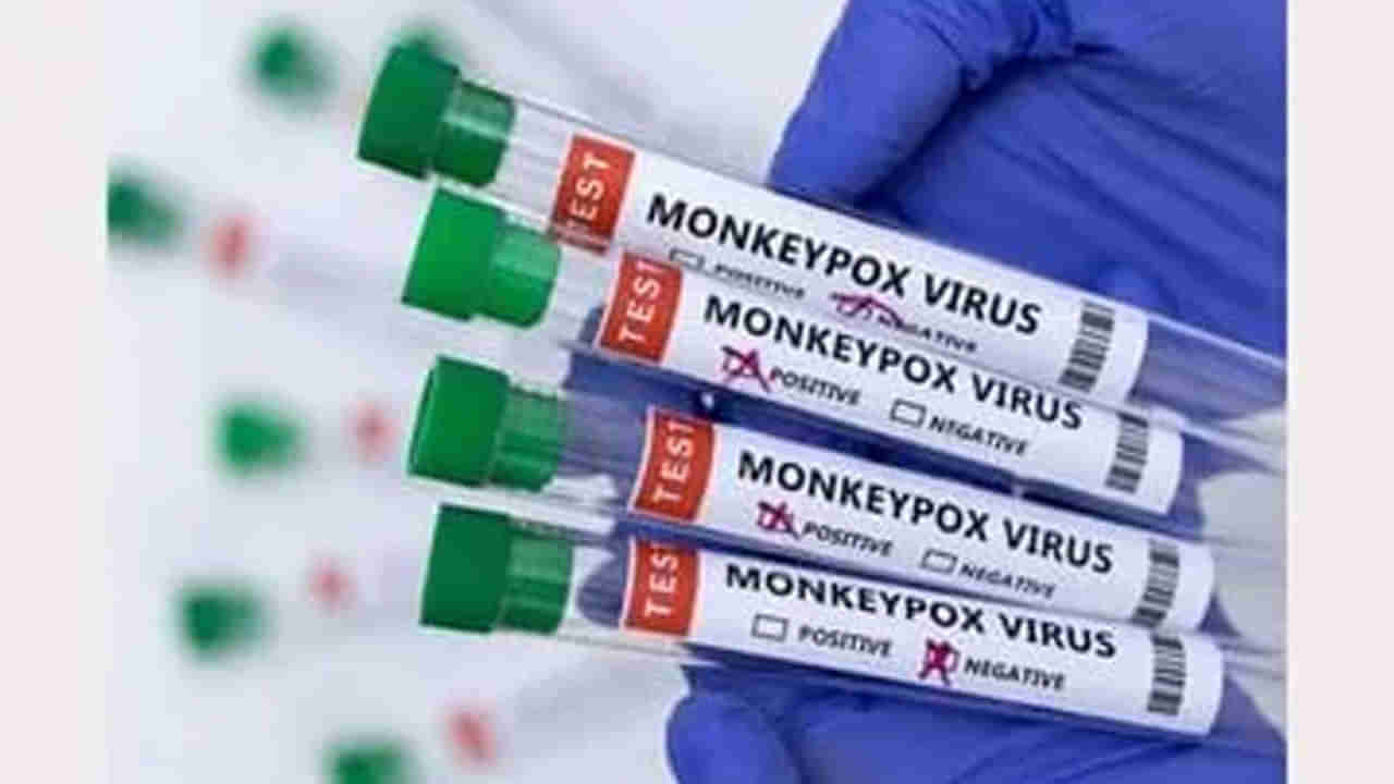 Monkeypox: చిన్నపిల్లలకు మంకీపాక్స్ వచ్చే ప్రమాదం ఉందా? నిపుణులు ఏం చెబుతున్నారంటే..!