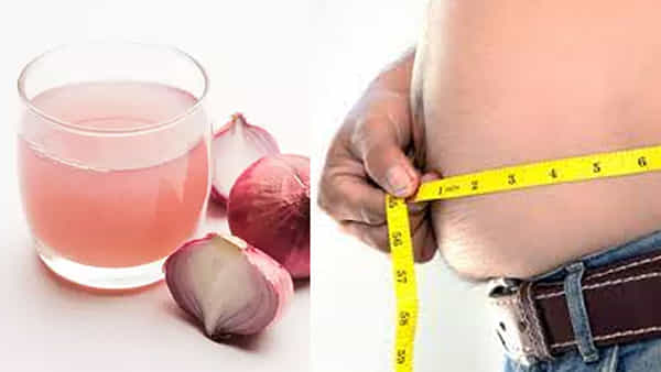 Onion Benefits: ఉల్లిపాయలతో ఇలా చేస్తే వారంలోనే అధిక బరువు హాంఫట్.. ఆ సమస్యలకు కూడా చెక్..