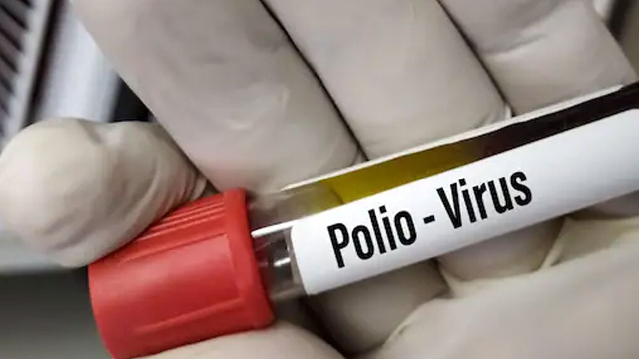 America Polio Case: అమెరికాలో నయా టెన్షన్.. పదేళ్ల తర్వాత వెలుగు చూసిన పోలియో కేసు..