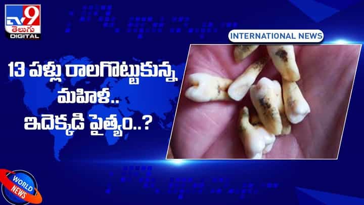 13 పళ్లు రాలగొట్టుకున్న మహిళ !! ఇదెక్కడి పైత్యం 13 పళ్లు రాలగొట్టుకున్న మహిళ !! ఇదెక్కడి పైత్యం