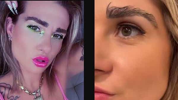 Eyebrow Transplant: తల వెంట్రుకలతో కనుబొమ్మలు ట్రాన్స్ప్లాంట్ చేయించుకున్న యువతి.. లక్షలు కుమ్మరించి మరీ..