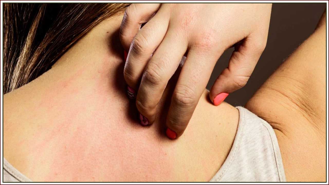 Allergy: ఇంట్లో ఉండే ఈ వస్తువులు మీకు అలర్జీని కలిగిస్తాయి..? నివారణ మార్గాలేంటి..?