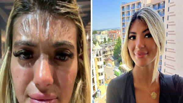 Beautician: అరగంట ఎండలో నిద్రపోయిన బ్యూటిషన్.. ఆ తర్వాత ఆమె చర్మం ప్లాస్టిక్లా మారిపోయింది!