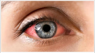Eye Diseases: టైప్-2 మధుమేహం ఉన్నవాళ్లకు కళ్లు దెబ్బతినే అవకాశం.. గ్లాకోమా వచ్చే ప్రమాదం