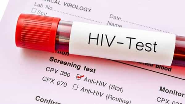 Viral: పెళ్లి కాలేదు.. ఎవరితోనూ శృంగారం చేయలేదు.. కానీ హెచ్ఐవీ పాజిటివ్ తేలింది.. కారణం తెలిస్తే ఫ్యూజులౌట్!