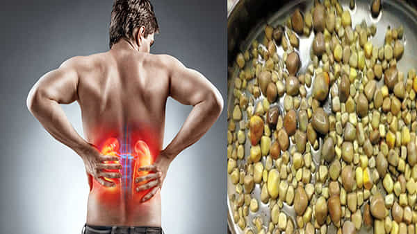 Health Tips :కిడ్నీలో స్టోన్స్తో బాధపడేవారు.. వీటికి దూరంగా ఉండాలి.. లేదంటే ప్రమాదమే..!