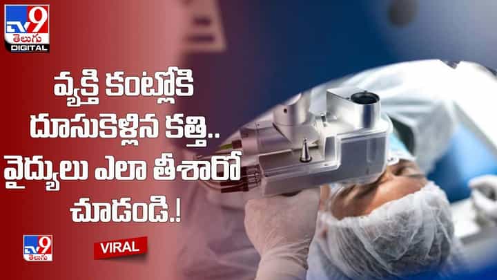 వ్యక్తి కంట్లోకి దూసుకెళ్లిన కత్తిని.. వైద్యులు ఎలా తీశారో చూడండి వ్యక్తి కంట్లోకి దూసుకెళ్లిన కత్తిని.. వైద్యులు ఎలా తీశారో చూడండి