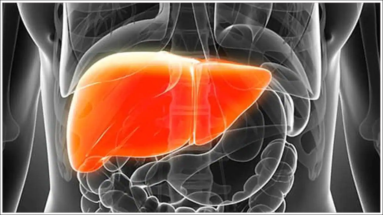 liver-disease