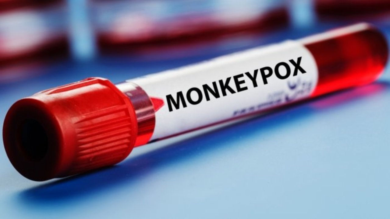 Monkeypox: మొదటి సారి నాలుగేళ్ల చిన్నారికి మంకీపాక్స్.. వైద్య నిపుణులకే అంతుచిక్కని లక్షణాలు..?