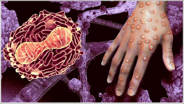 Monkeypox: మంకీపాక్స్ వైరస్ గురించి షాకింగ్ విషయాలు.. వాటిపై వైరస్ నెలల తరబడి ఉంటుంది: అధ్యయనంలో స్పష్టం