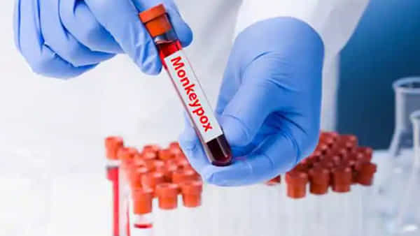 Monkeypox Test Kit: మొట్ట మొదటి స్వదేశీ మంకీపాక్స్ ఆర్టీపీసీఆర్ టెస్ట్ కిట్ విడుదల.. వివరాలు ఇవే..