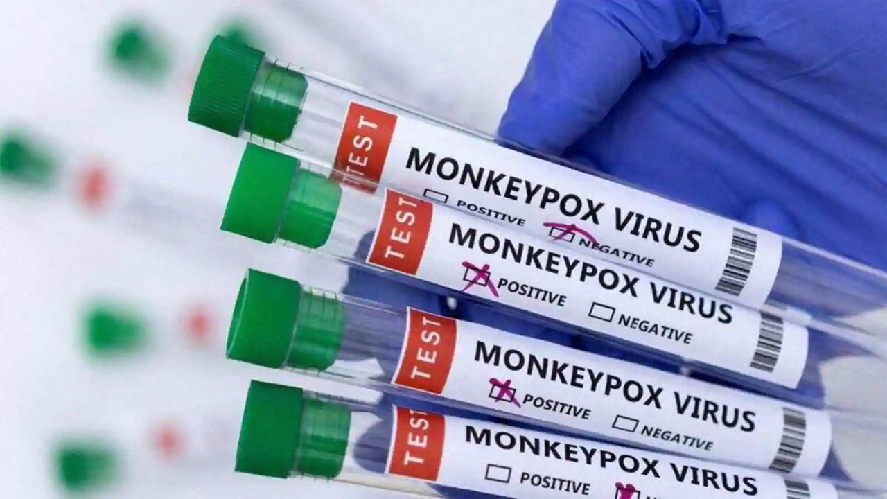 Monkeypox: ఆ బాలుడికి మంకీపాక్స్‌ నెగెటివ్‌ నిర్ధారణ.. ఊపిరి పీల్చుకున్న అధికారులు..!