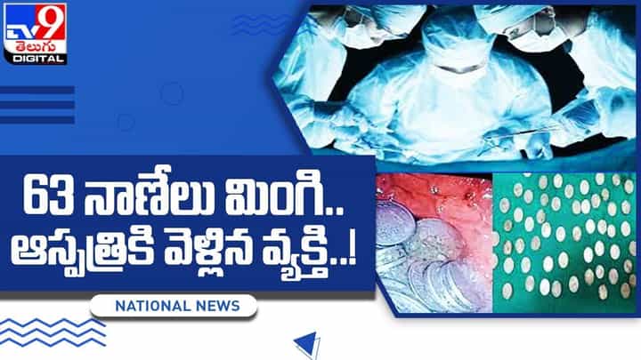 63 నాణేలు మింగి వ్యక్తి !! 48గంటల పాటు ఆపరేషన్ !! చివరికి ఏమైందంటే ?? 63 నాణేలు మింగి వ్యక్తి !! 48గంటల పాటు ఆపరేషన్ !! చివరికి ఏమైందంటే ??