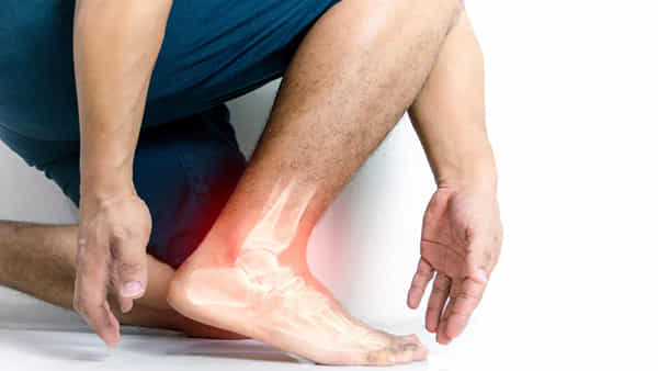 Uric Acid: ఈ కారణాలతో యూరిక్ యాసిడ్ ఏర్పడుతుంది.. ఆ నొప్పిని ఎలా తగ్గించుకోవాలంటే..