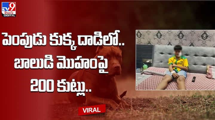 పెంపుడు కుక్క దాడిలో.. బాలుడిపై మొహంపై 200 కుట్లు పెంపుడు కుక్క దాడిలో.. బాలుడిపై మొహంపై 200 కుట్లు