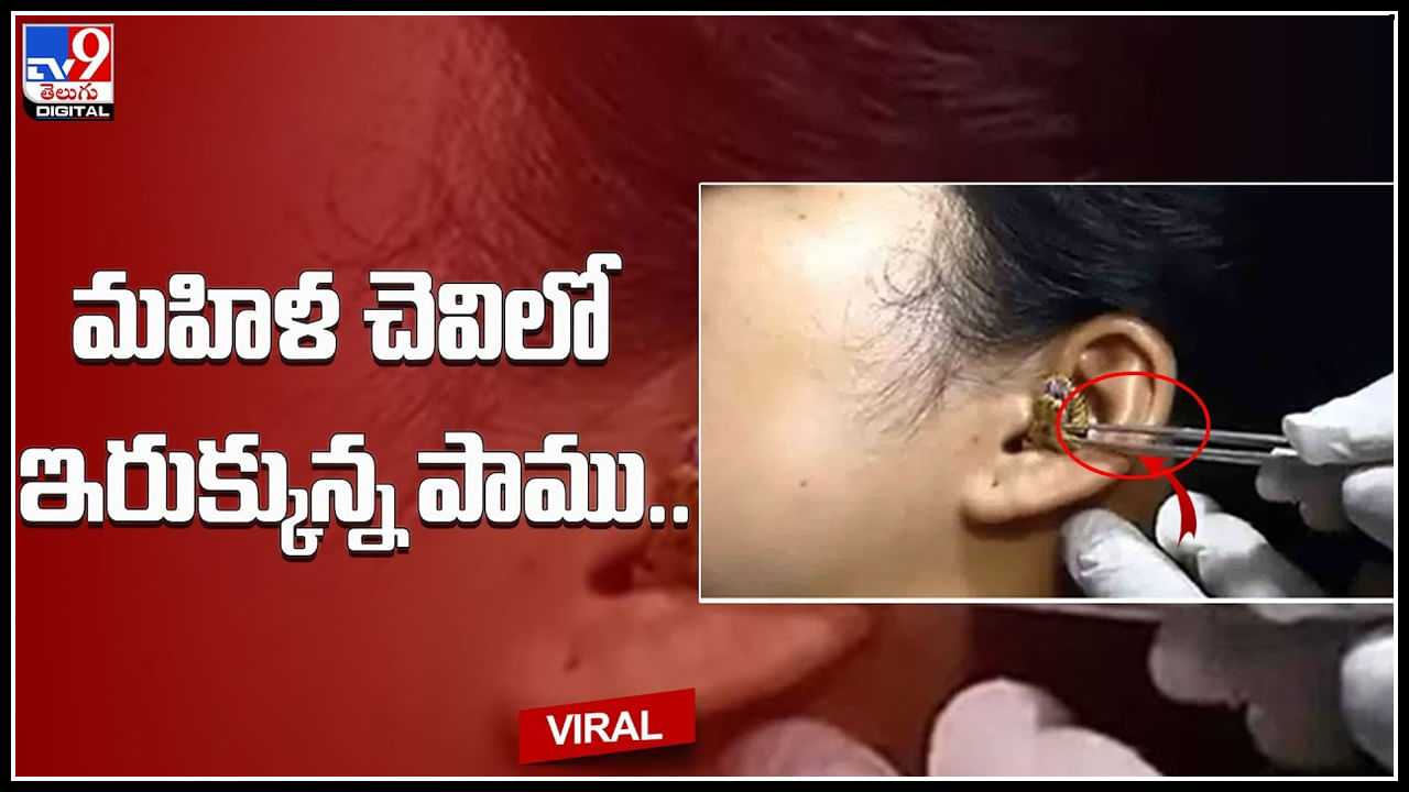 Snake in ear: మహిళ చెవిలో ఇరుక్కున్న పాము.. బయటకు తీసేందుకు డాక్టర్‌ తంటాలు.. షాకింగ్‌ వీడియో.