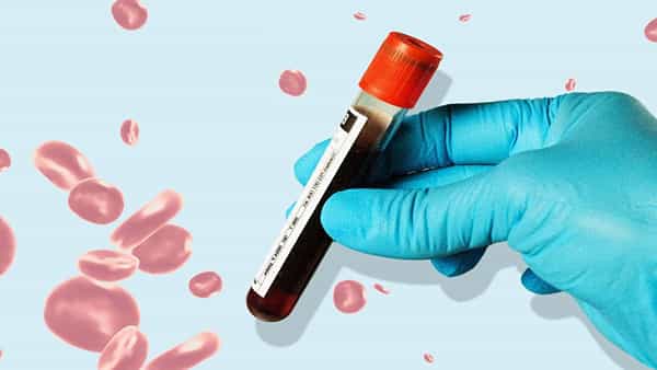 Health: తరుచుగా ఇలా చేస్తే కాన్సర్ సహా అనేక వ్యాధులను ఇట్టే గుర్తించొచ్చు.. లైఫ్ టైం కూడా పెరుగుతుంది..