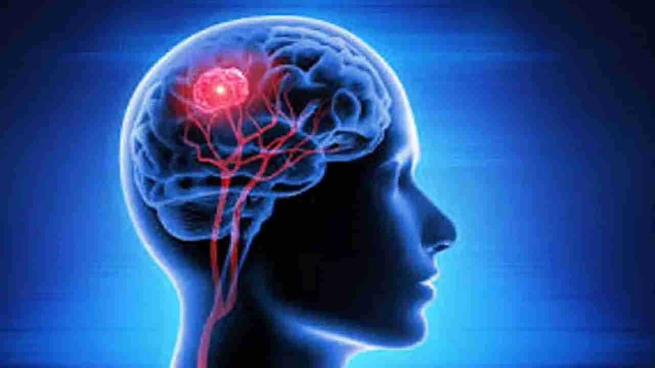 Brain Tumor: ఉదయం లేవగానే తలనొప్పి వస్తుందా? బ్రెయిన్ ట్యూమర్ లక్షణాలివే.. చెక్ చేసుకోండి..!