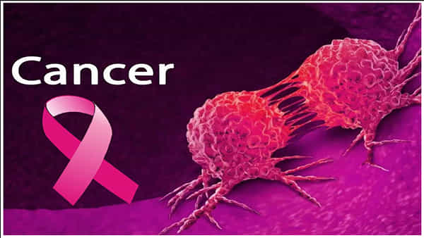 Cancer Risk Factors: ఈ కారణాలతోనే క్యాన్సర్ వ్యాప్తి.. అజాగ్రత్తగా ఉంటే ప్రాణానికే ప్రమాదం..