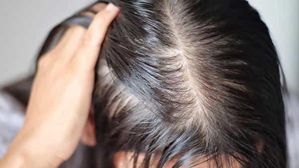 Hair Health: స్మార్ట్ ఫోన్ అధికంగా వాడితే పేలు వస్తాయా.. నిపుణుల అధ్యయనంలో ఆసక్తికర విషయాలు