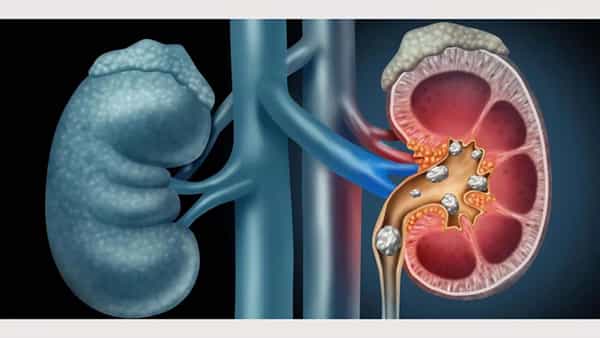 Health Tips: ఈ 10 అలవాట్లు మీకు ఉన్నాయా.. అయితే, మీ కిడ్నీలు ప్రమాదంలో పడ్డట్లే.. అవేంటంటే?
