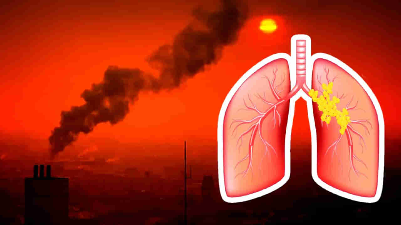 Lung Cancer: పొగాకు తాగని వారికి కూడా ఊపిరితిత్తుల క్యాన్సర్ వచ్చే ప్రమాదం.. పరిశోధనలలో షాకింగ్‌ నిజాలు