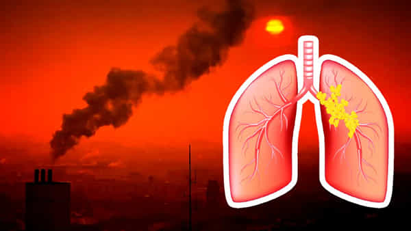 Lung Cancer: పొగాకు తాగని వారికి కూడా ఊపిరితిత్తుల క్యాన్సర్ వచ్చే ప్రమాదం.. పరిశోధనలలో షాకింగ్ నిజాలు