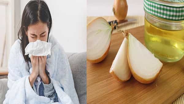 Home Remedies: జలుబు, ఫ్లూ, దగ్గు వంటి సీజనల్ వ్యాధుల ఉపశమనానికి వంటింటి చిట్కాలు.. ఉల్లిపాయను ఇలా ఉపయోగించి చూడండి..