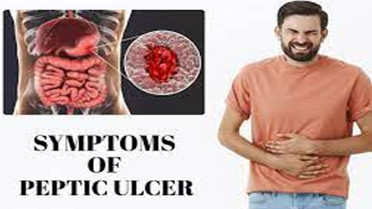 Peptic Ulcer: కడుపులో అల్సర్లు ఎందుకు వస్తాయో తెలుసా? ఈ లక్షణాలు కనిపిస్తే వెంటనే..
