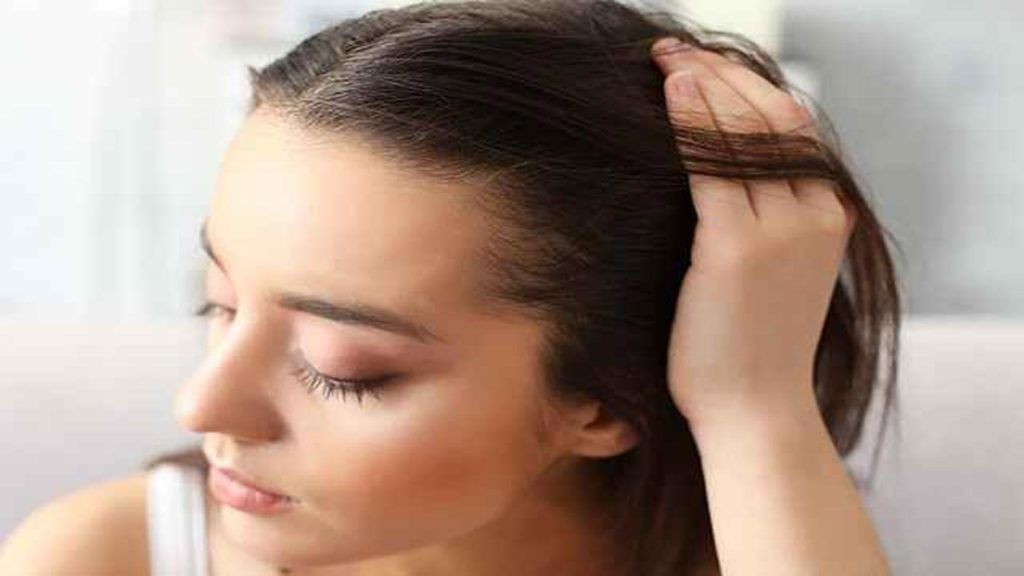 Remedies For Dandruff