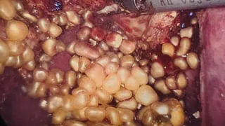 Crime: సినిమా చూసి సొంత బామ్మనే చంపేశాడు.. మృతదేహాన్ని ముక్కలు ముక్కలుగా నరికి.. దర్యాప్తులో షాకింగ్ విషయాలు