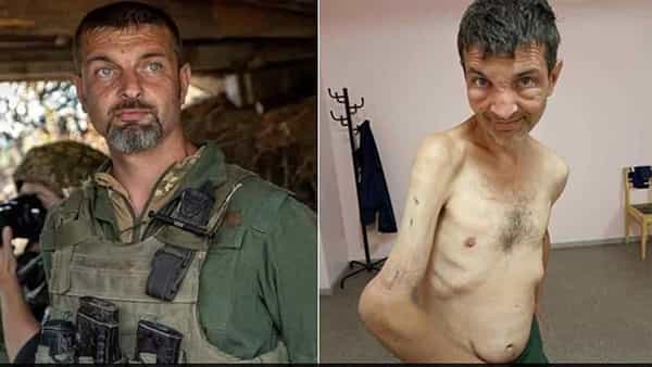 Ukraine Russian war: దారుణం! ఉక్రెయిన్ సైనికుడిని బతికున్న శవంలా మార్చిన రష్యన్లు.. మనసులను కలచివేస్తోన్న ఫొటో..