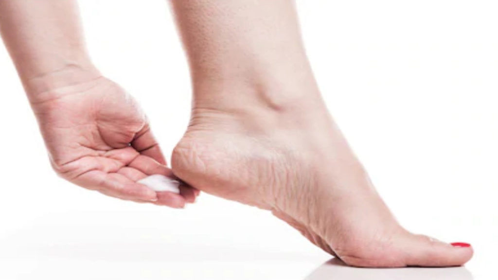 Uric Acid Symptoms
